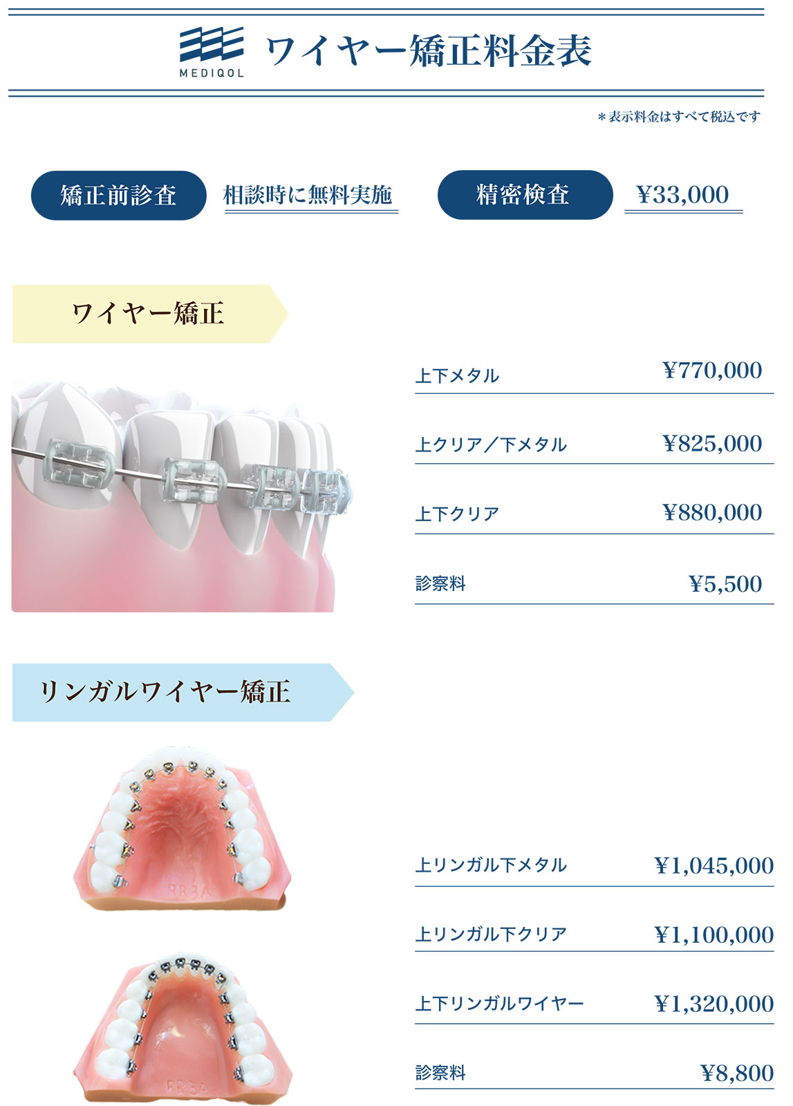 ワイヤー矯正料金表